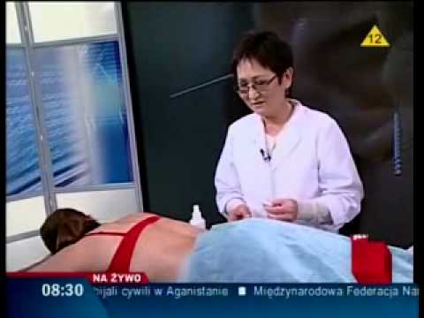 Dzień dobry Polsko - leczenie igłami