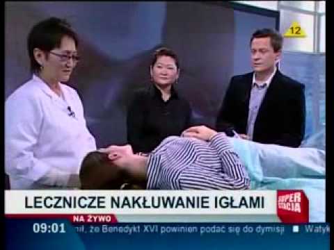 Dzień dobry Polsko – akupunktura uszu