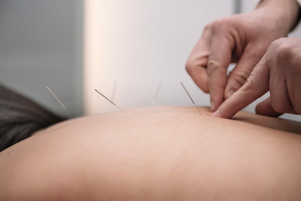 Akupunktura w Warszawie
